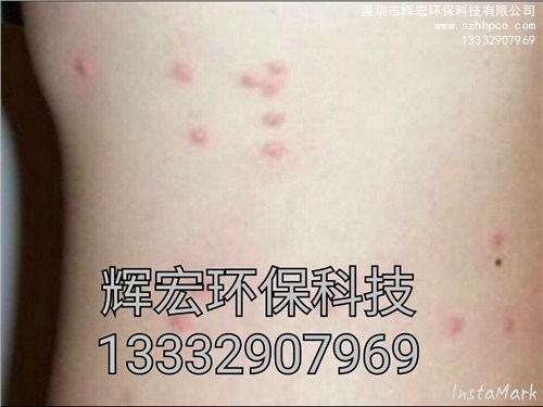 深圳殺臭蟲公司 |深圳殺臭蟲 |深圳宿舍殺臭蟲公司 |輝宏供-- 深圳市輝宏環保科技有限公司